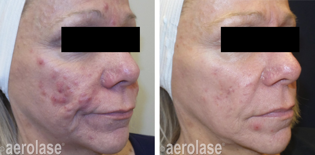 Before & After