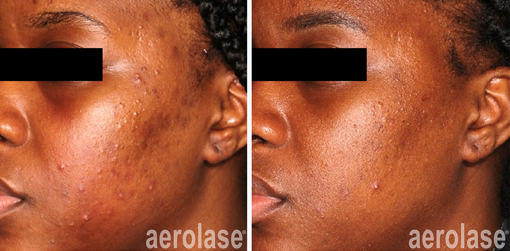 Before & After