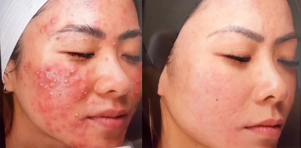 Before & After