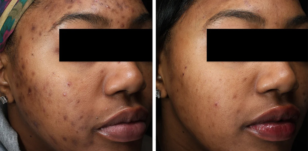 Before & After