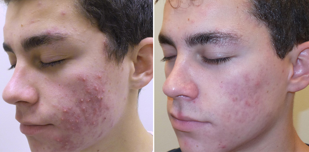 Before & After